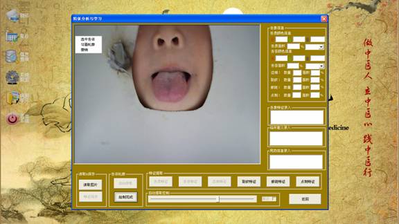 中医舌象智能辅助诊断系统手工绘制菜单